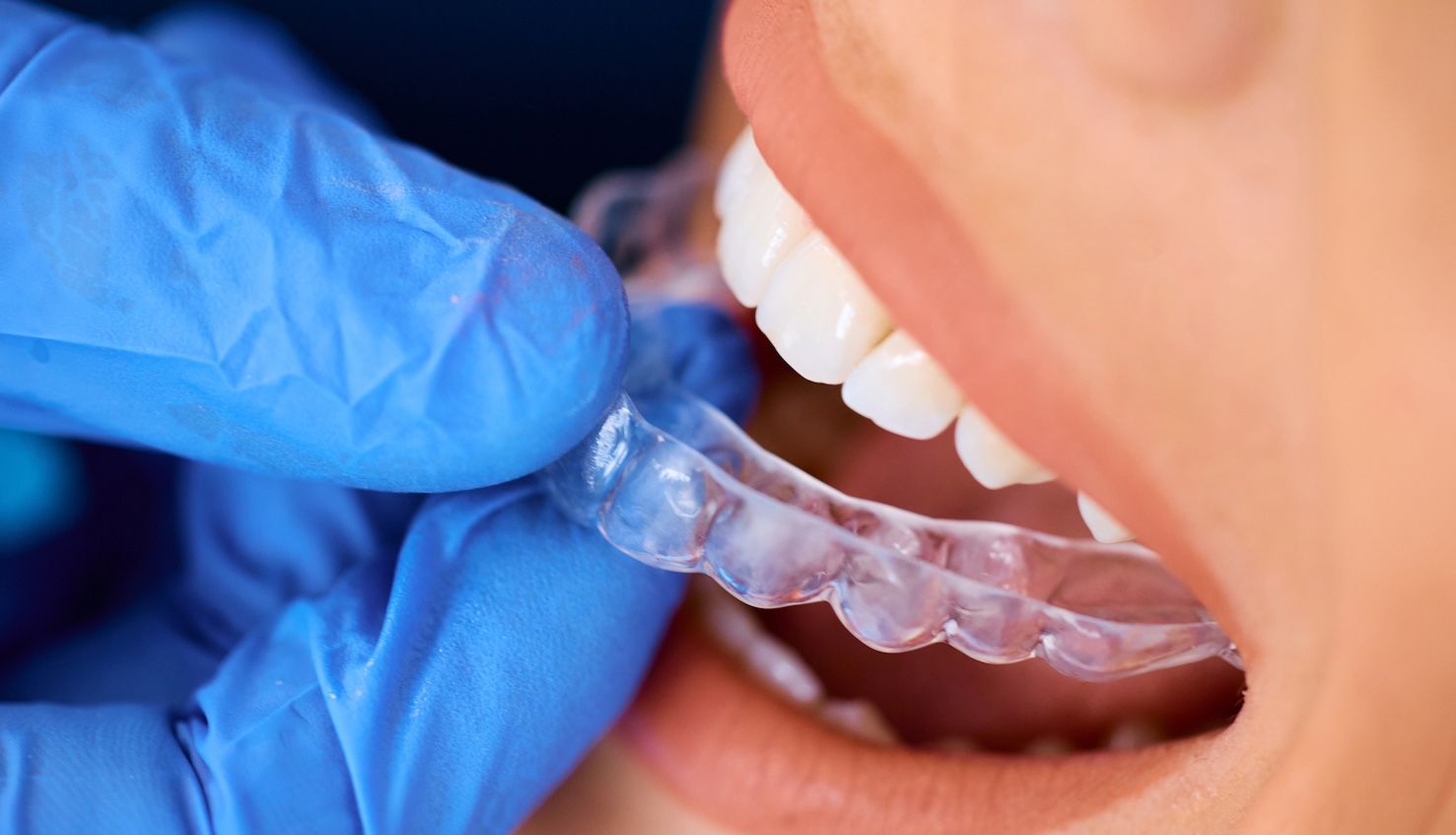 service illustration