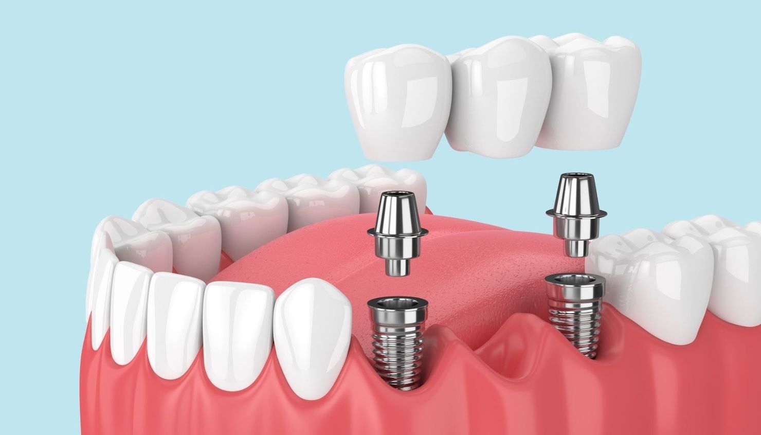 service illustration